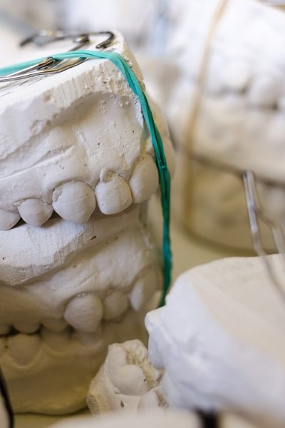 teeth, models, gypsum-797308.jpg